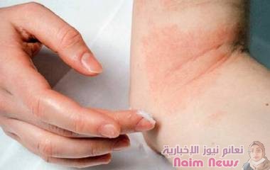 ما سبب ظهور البقع الحمراء على الجسم؟