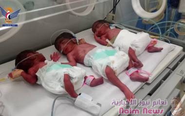 امرأة ثلاثينية تضع ثلاثة توائم إناث بمستشفى عمران العام