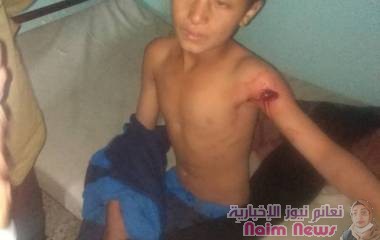 عااااااجل #انتهاكات وجرائم حوثيه جديده بحق الطفوله في #الشقب بوابة #تعز #اليمن* 