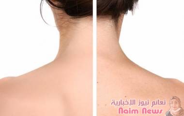 تخلصي من حبوب الظهر والأكتاف بخلطات منزلية