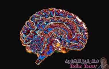 تقنية تصوير جديدة تكشف منطقة الدماغ الأكثر تضررا من "كوفيد-19"