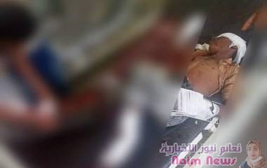 الحديدة| ‏إصابة الطفل عدنان طاهر حشاش"