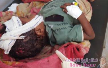 مجزرة جديدة بحق الطفولة ترتكبها ميليشيات الحوثي الإرهابية في عزلة براشة بمقبنة